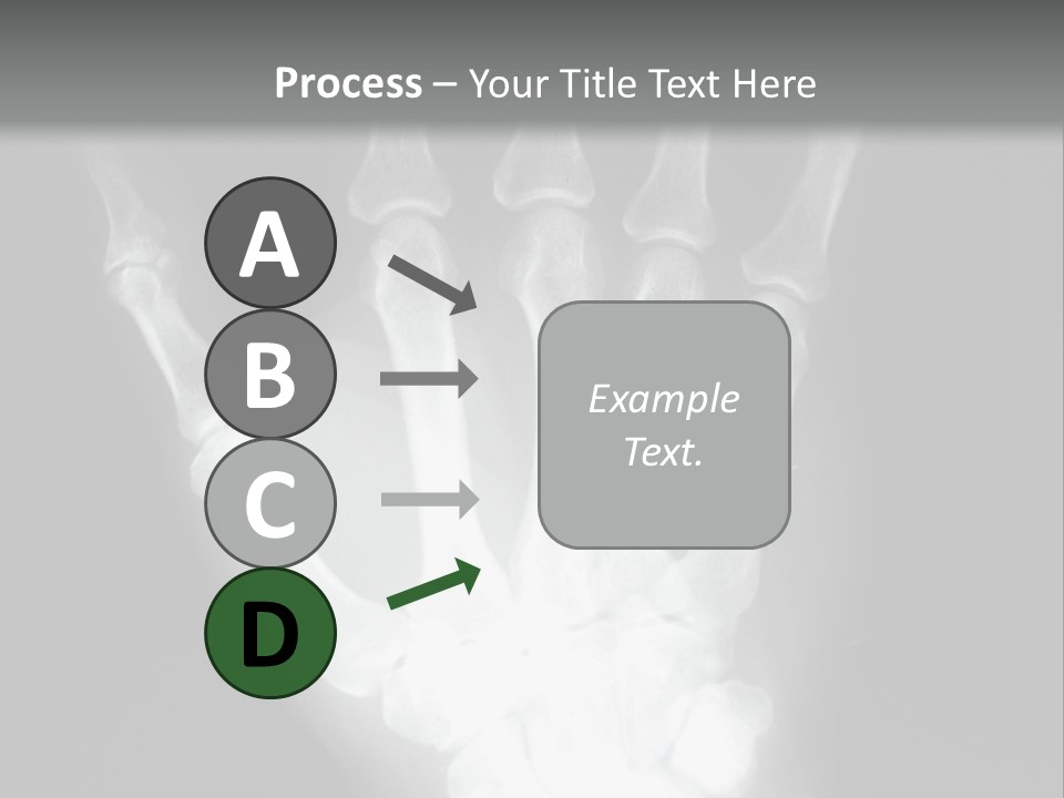 A Skeleton Hand Is Shown In This Presentation PowerPoint Template