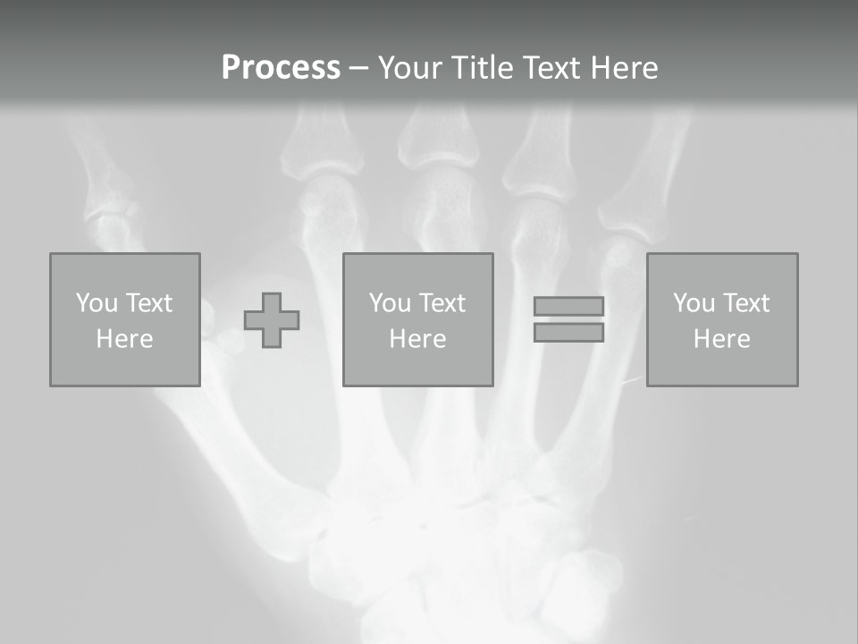 A Skeleton Hand Is Shown In This Presentation PowerPoint Template