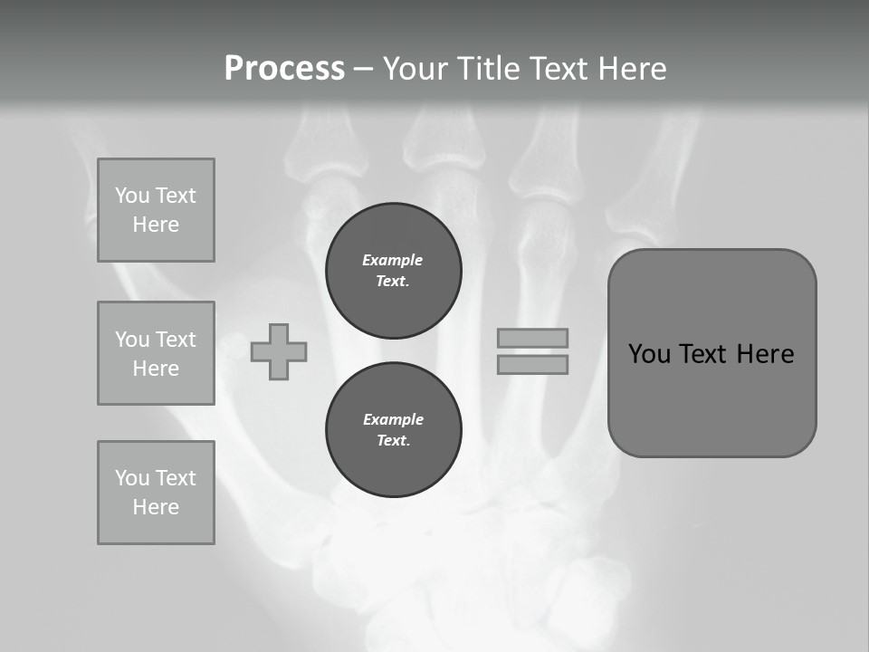A Skeleton Hand Is Shown In This Presentation PowerPoint Template