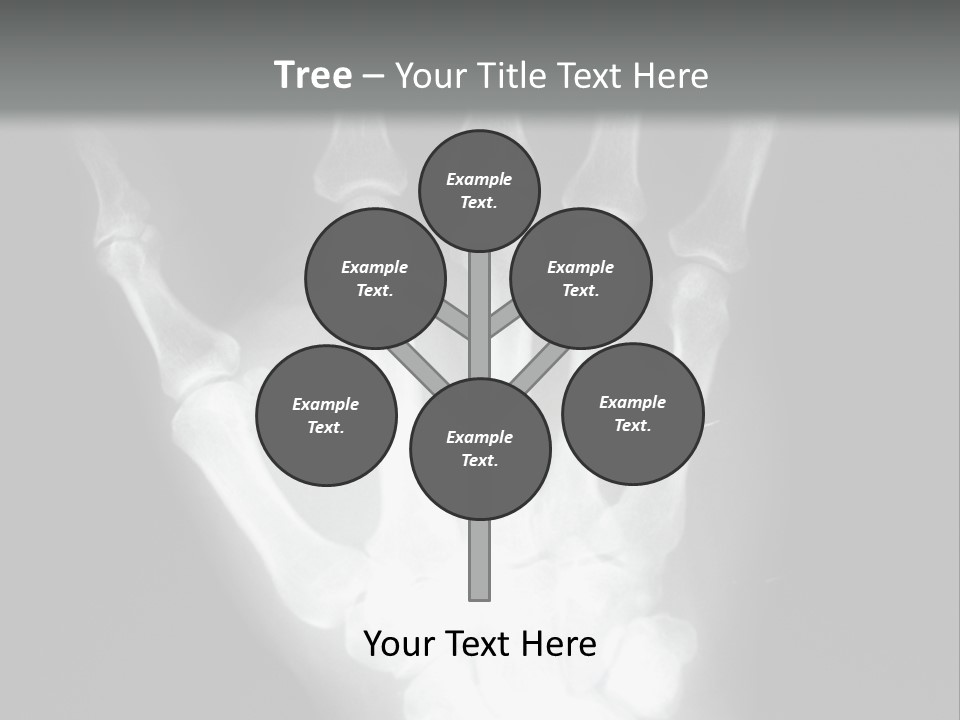 A Skeleton Hand Is Shown In This Presentation PowerPoint Template