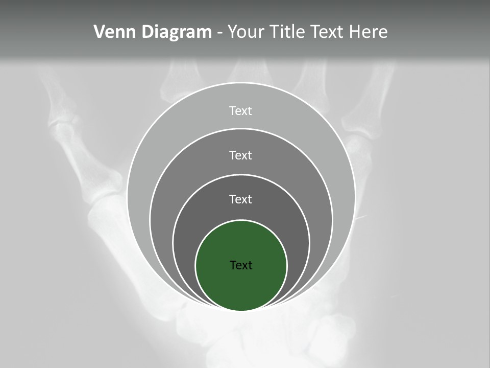 A Skeleton Hand Is Shown In This Presentation PowerPoint Template