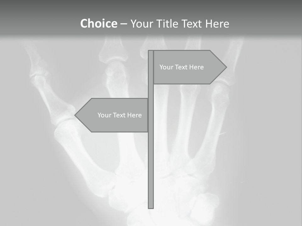 A Skeleton Hand Is Shown In This Presentation PowerPoint Template