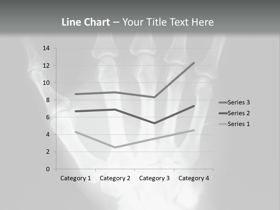 A Skeleton Hand Is Shown In This Presentation PowerPoint Template