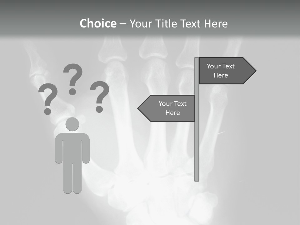 A Skeleton Hand Is Shown In This Presentation PowerPoint Template