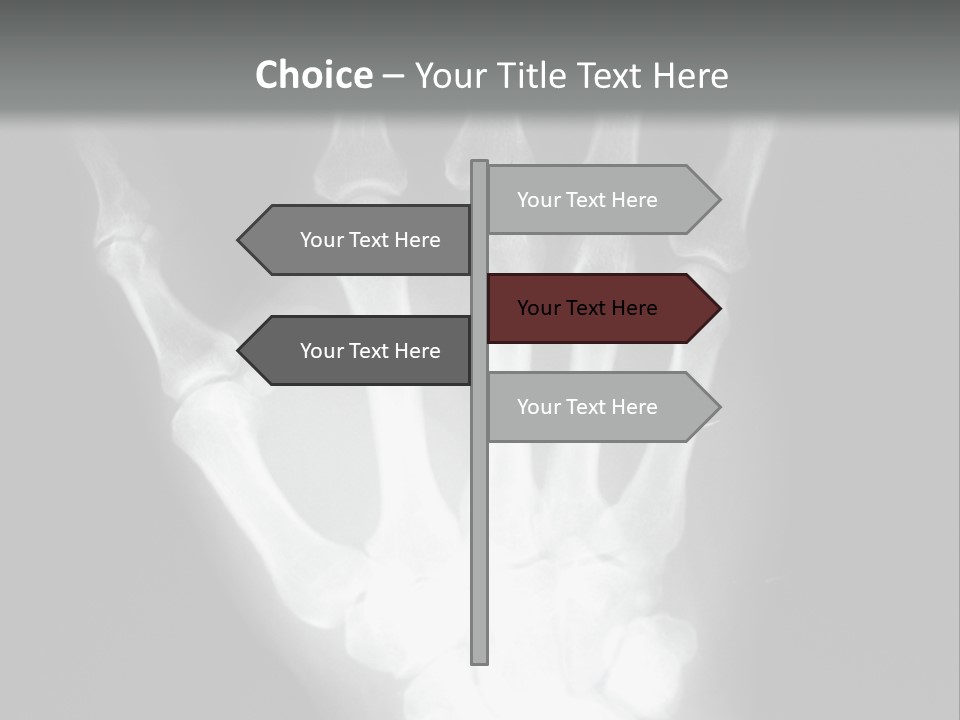 A Skeleton Hand Is Shown In This Presentation PowerPoint Template