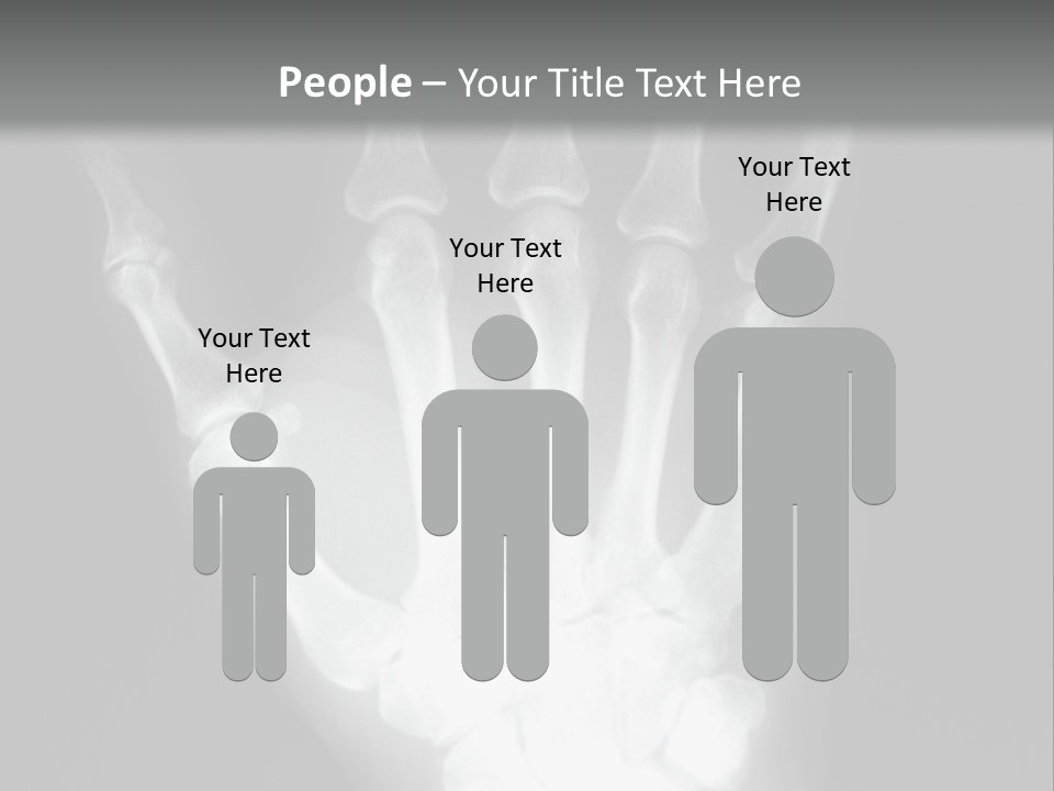 A Skeleton Hand Is Shown In This Presentation PowerPoint Template