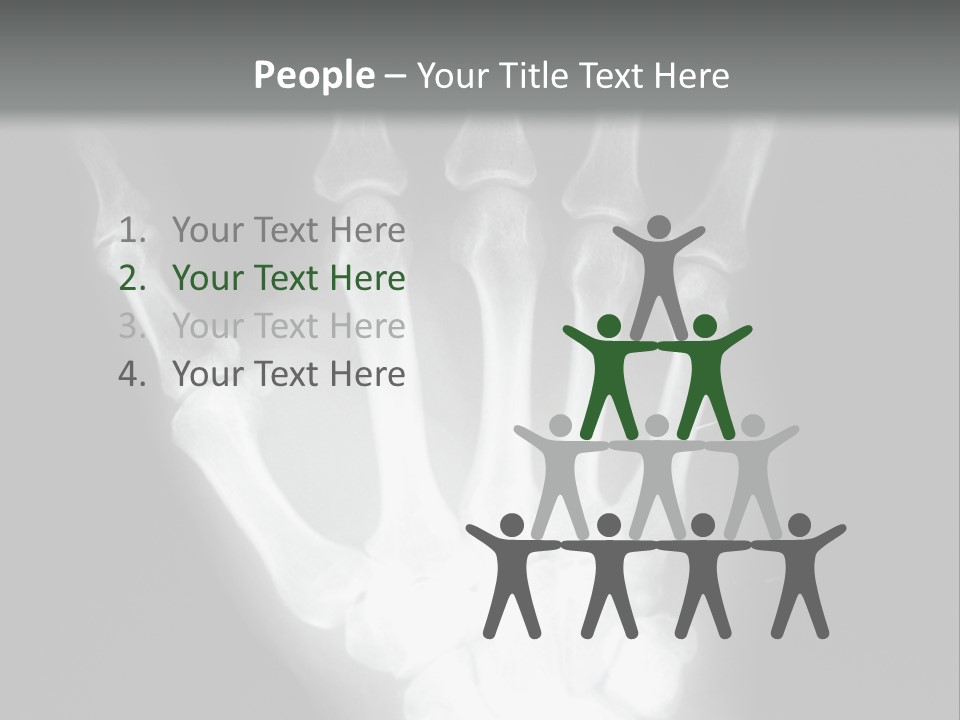 A Skeleton Hand Is Shown In This Presentation PowerPoint Template