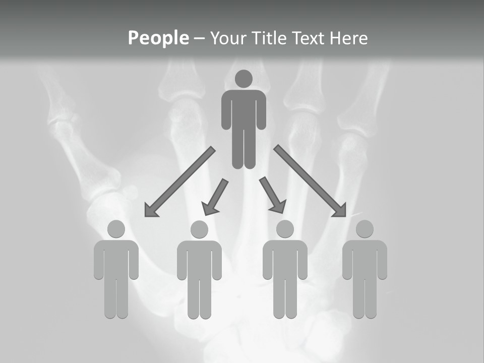 A Skeleton Hand Is Shown In This Presentation PowerPoint Template