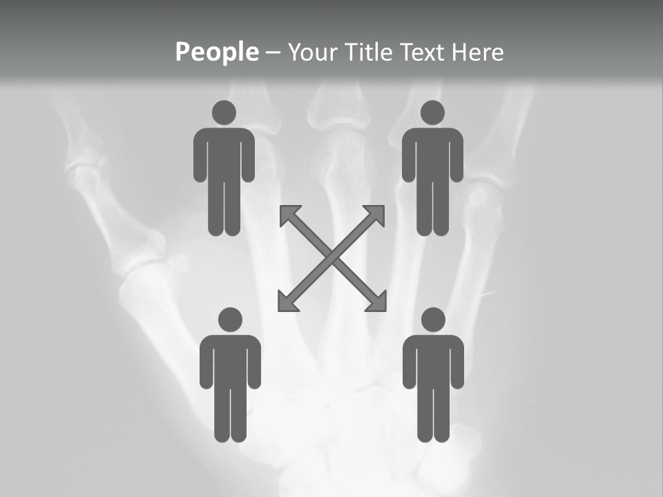 A Skeleton Hand Is Shown In This Presentation PowerPoint Template