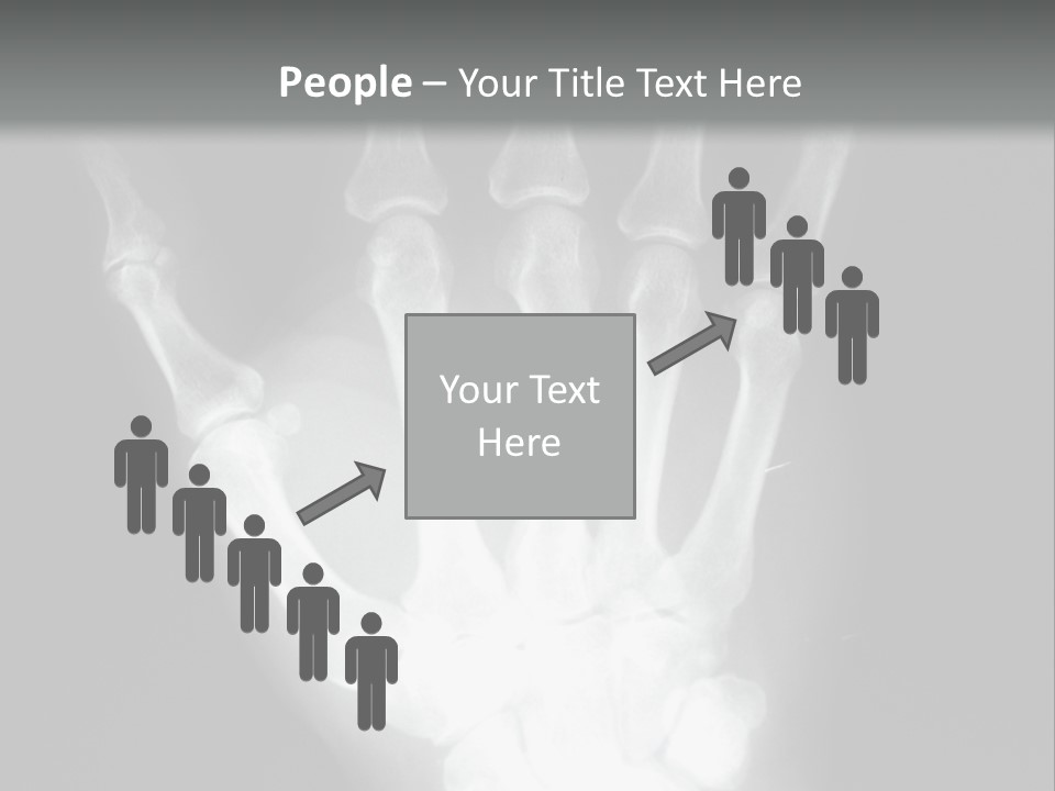 A Skeleton Hand Is Shown In This Presentation PowerPoint Template
