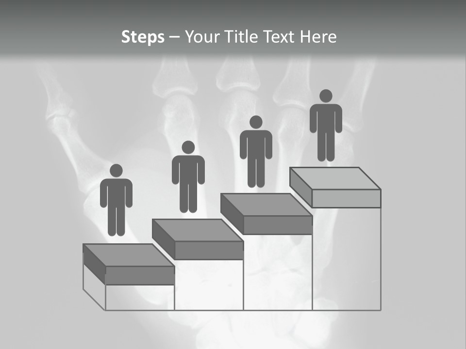 A Skeleton Hand Is Shown In This Presentation PowerPoint Template