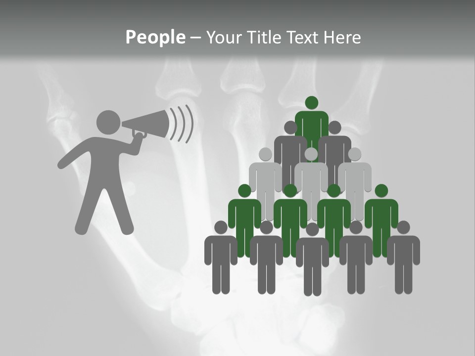 A Skeleton Hand Is Shown In This Presentation PowerPoint Template