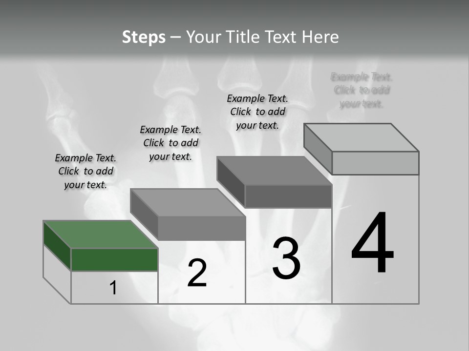 A Skeleton Hand Is Shown In This Presentation PowerPoint Template