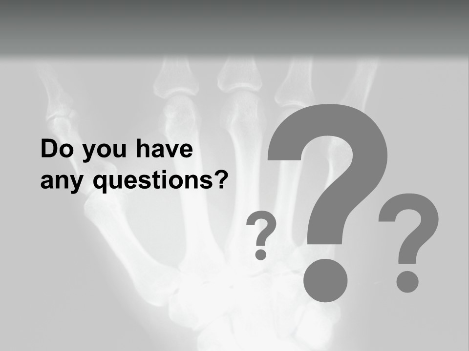 A Skeleton Hand Is Shown In This Presentation PowerPoint Template