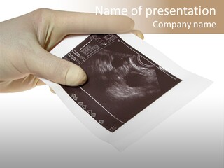 Doctor Hands With Ovary Sonogram PowerPoint Template