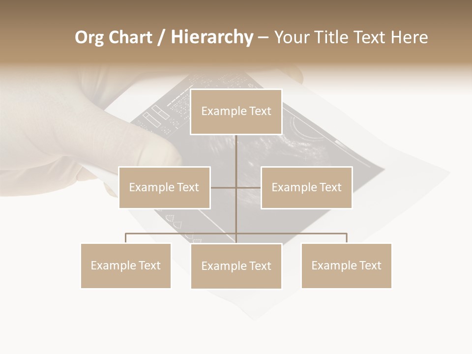 Doctor Hands With Ovary Sonogram PowerPoint Template