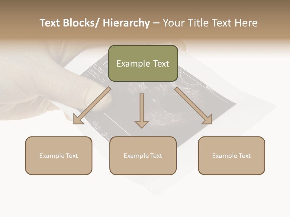 Doctor Hands With Ovary Sonogram PowerPoint Template