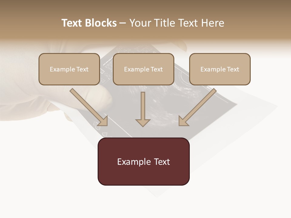 Doctor Hands With Ovary Sonogram PowerPoint Template