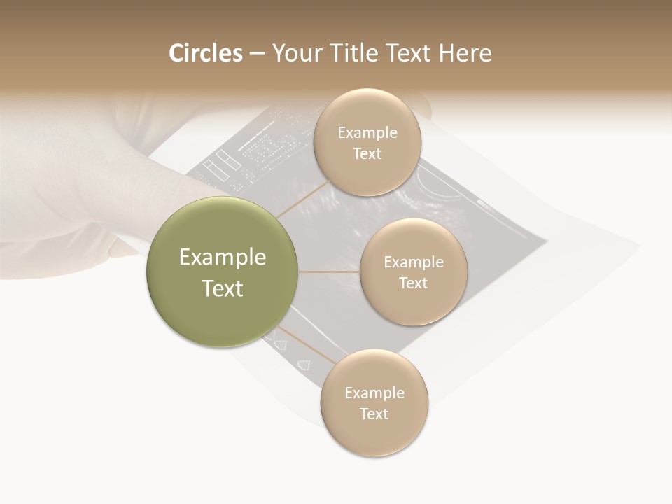 Doctor Hands With Ovary Sonogram PowerPoint Template