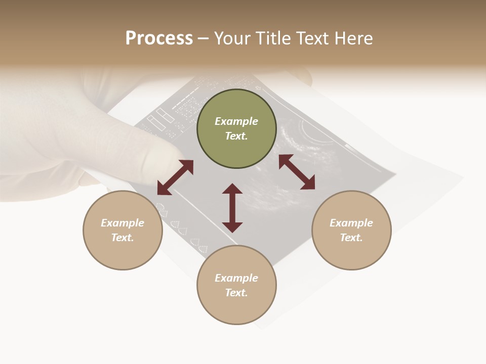 Doctor Hands With Ovary Sonogram PowerPoint Template