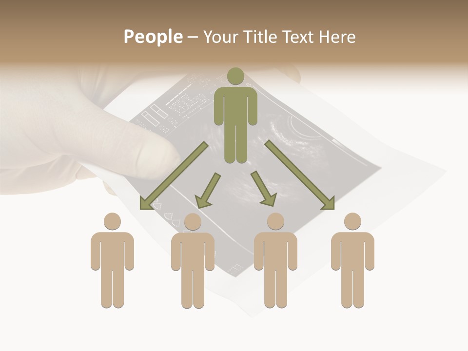 Doctor Hands With Ovary Sonogram PowerPoint Template