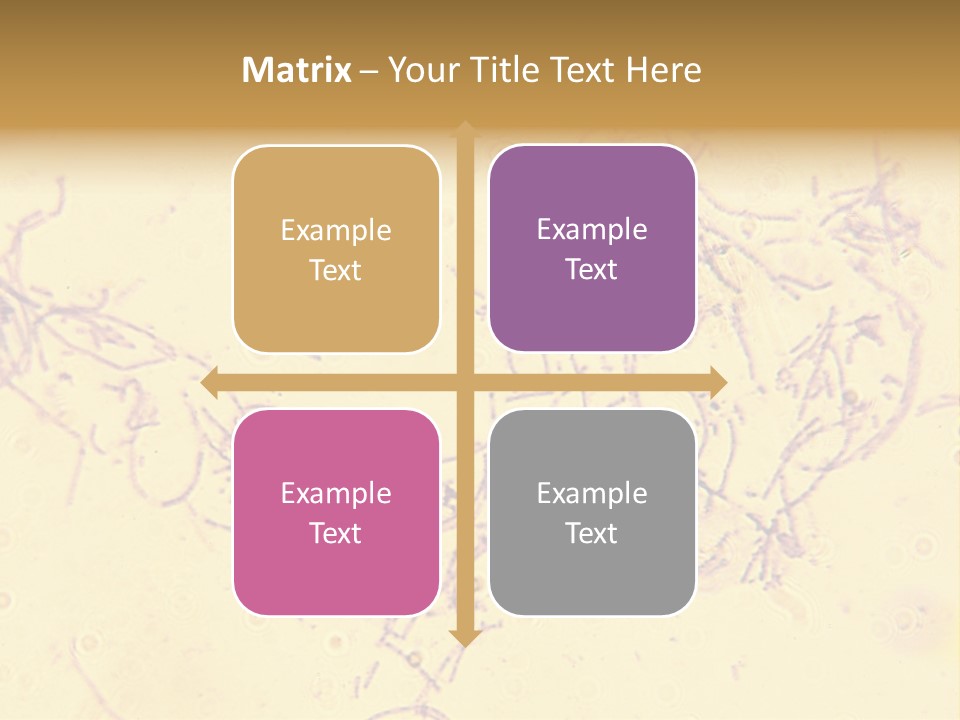 Microscope Photo Of Anthrax (Bacillus Anthracis). Focus=Left Center. 14Mp Camera, Microscope At 45X. PowerPoint Template