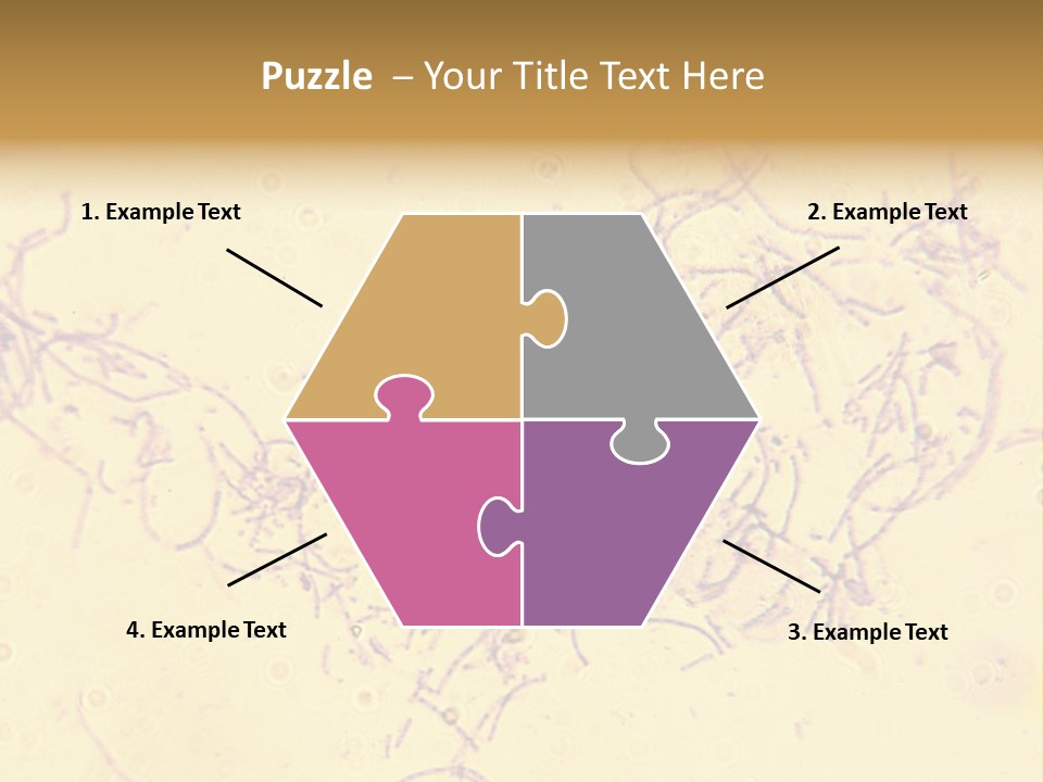 Microscope Photo Of Anthrax (Bacillus Anthracis). Focus=Left Center. 14Mp Camera, Microscope At 45X. PowerPoint Template