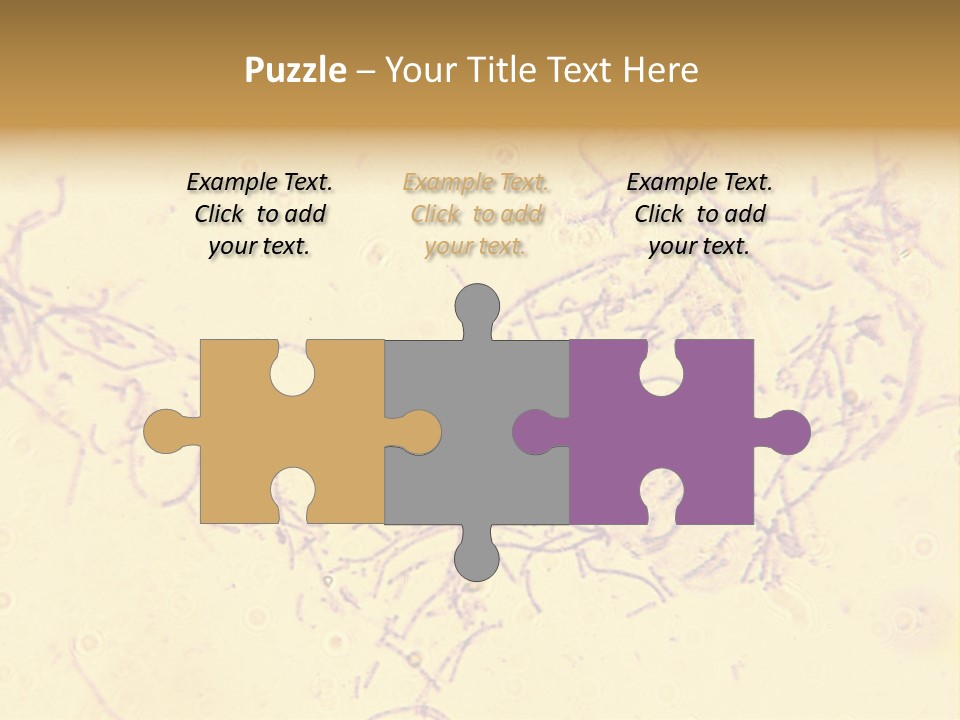 Microscope Photo Of Anthrax (Bacillus Anthracis). Focus=Left Center. 14Mp Camera, Microscope At 45X. PowerPoint Template