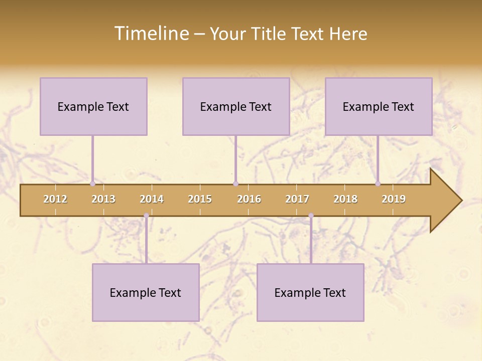 Microscope Photo Of Anthrax (Bacillus Anthracis). Focus=Left Center. 14Mp Camera, Microscope At 45X. PowerPoint Template
