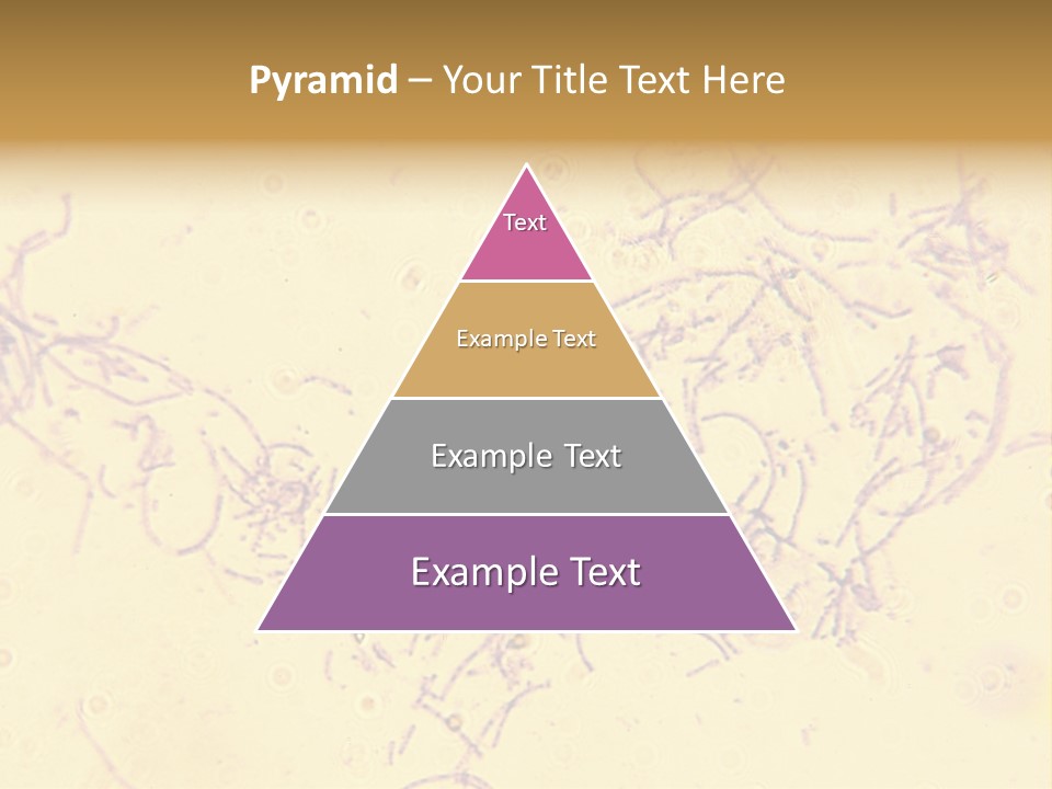 Microscope Photo Of Anthrax (Bacillus Anthracis). Focus=Left Center. 14Mp Camera, Microscope At 45X. PowerPoint Template