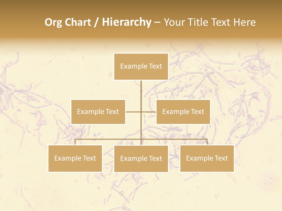 Microscope Photo Of Anthrax (Bacillus Anthracis). Focus=Left Center. 14Mp Camera, Microscope At 45X. PowerPoint Template