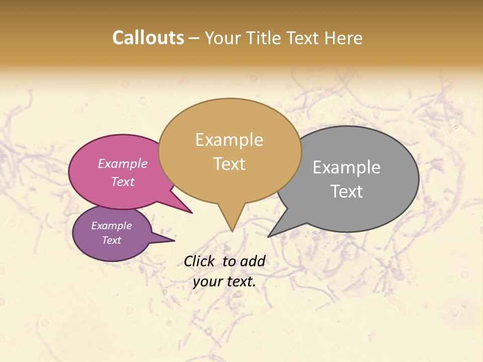 Microscope Photo Of Anthrax (Bacillus Anthracis). Focus=Left Center. 14Mp Camera, Microscope At 45X. PowerPoint Template