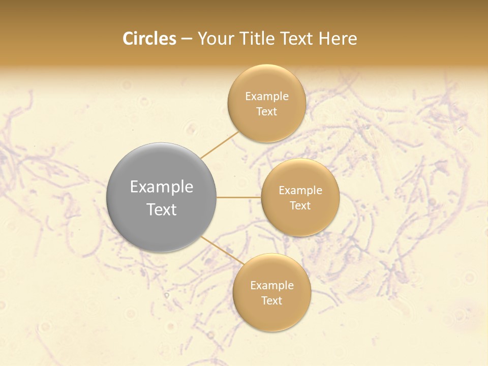 Microscope Photo Of Anthrax (Bacillus Anthracis). Focus=Left Center. 14Mp Camera, Microscope At 45X. PowerPoint Template