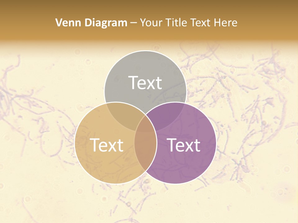 Microscope Photo Of Anthrax (Bacillus Anthracis). Focus=Left Center. 14Mp Camera, Microscope At 45X. PowerPoint Template