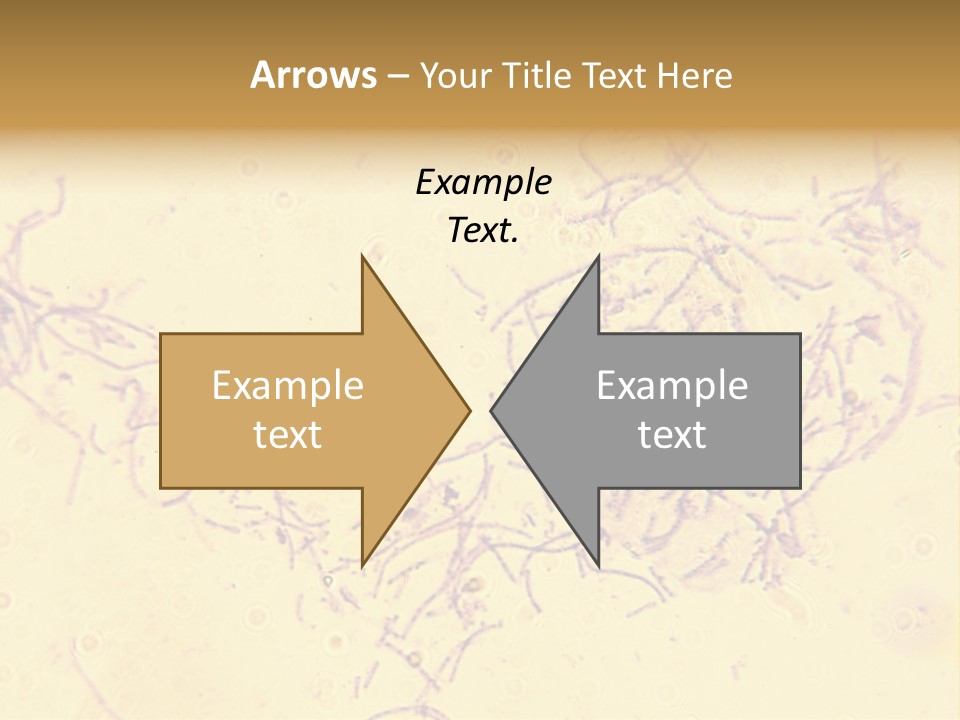 Microscope Photo Of Anthrax (Bacillus Anthracis). Focus=Left Center. 14Mp Camera, Microscope At 45X. PowerPoint Template
