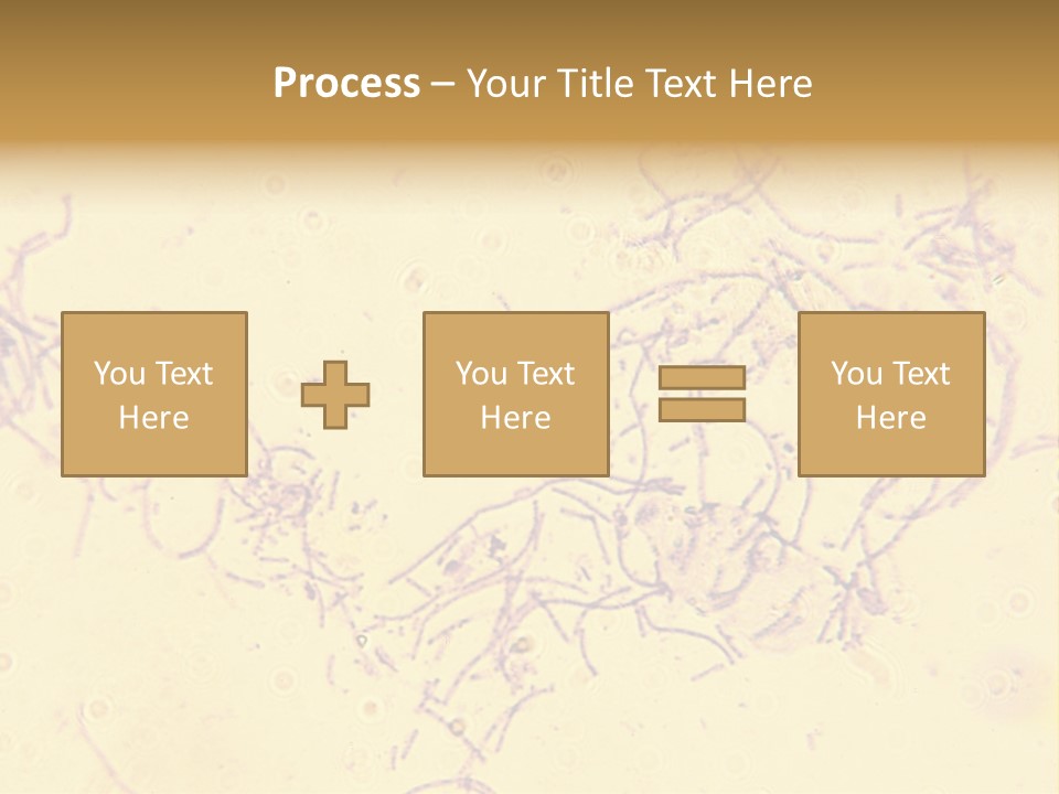 Microscope Photo Of Anthrax (Bacillus Anthracis). Focus=Left Center. 14Mp Camera, Microscope At 45X. PowerPoint Template