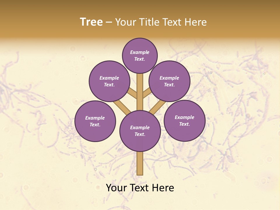 Microscope Photo Of Anthrax (Bacillus Anthracis). Focus=Left Center. 14Mp Camera, Microscope At 45X. PowerPoint Template