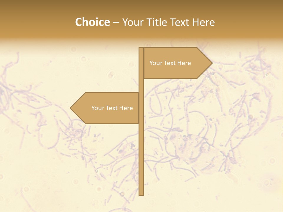 Microscope Photo Of Anthrax (Bacillus Anthracis). Focus=Left Center. 14Mp Camera, Microscope At 45X. PowerPoint Template