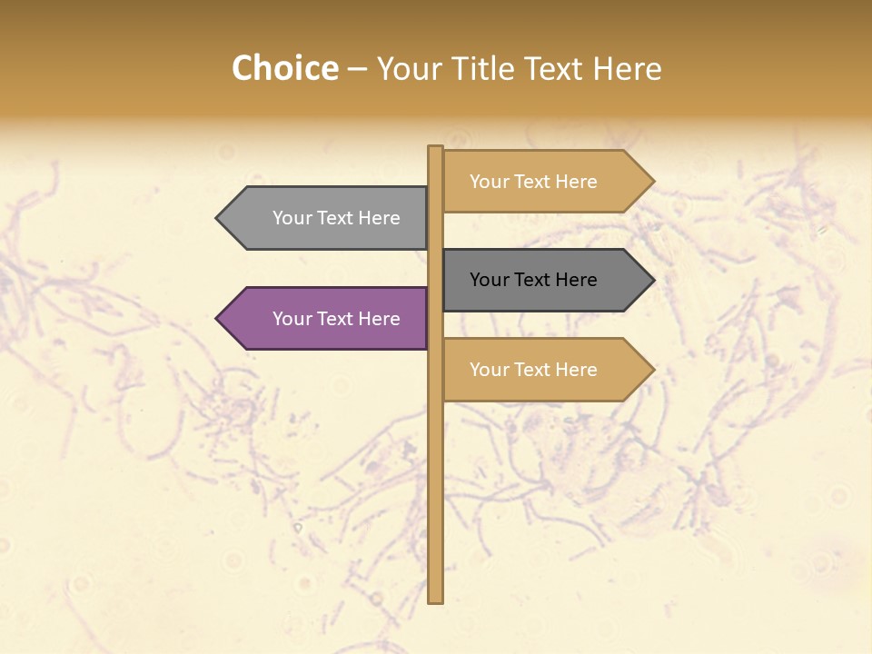 Microscope Photo Of Anthrax (Bacillus Anthracis). Focus=Left Center. 14Mp Camera, Microscope At 45X. PowerPoint Template