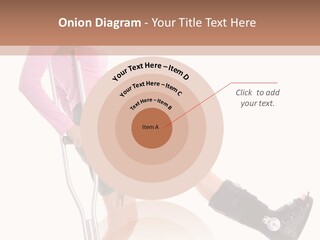 Woman With An Ortho Boot PowerPoint Template