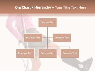Woman With An Ortho Boot PowerPoint Template
