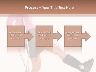 Woman With An Ortho Boot PowerPoint Template