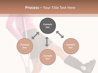Woman With An Ortho Boot PowerPoint Template