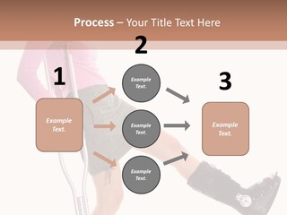 Woman With An Ortho Boot PowerPoint Template