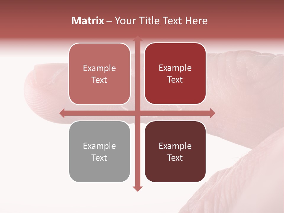 Closeup Of Eczema On Male Finger With Skin Peeling PowerPoint Template
