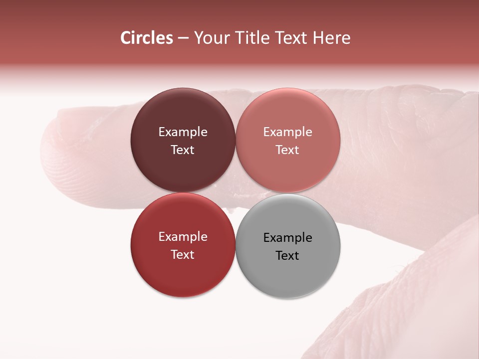 Closeup Of Eczema On Male Finger With Skin Peeling PowerPoint Template