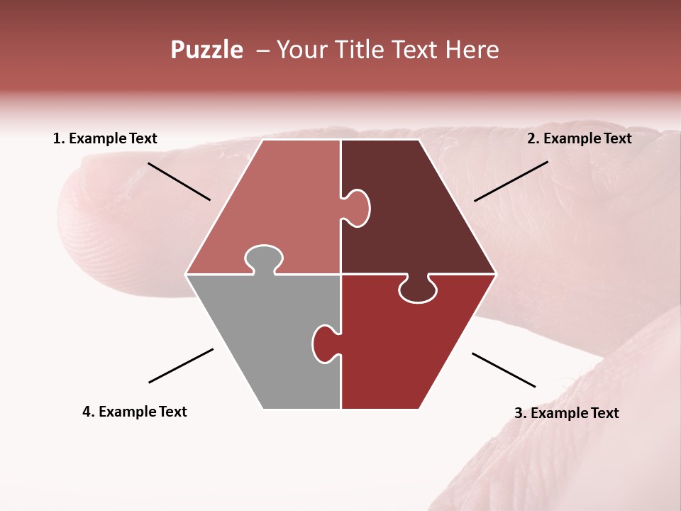 Closeup Of Eczema On Male Finger With Skin Peeling PowerPoint Template