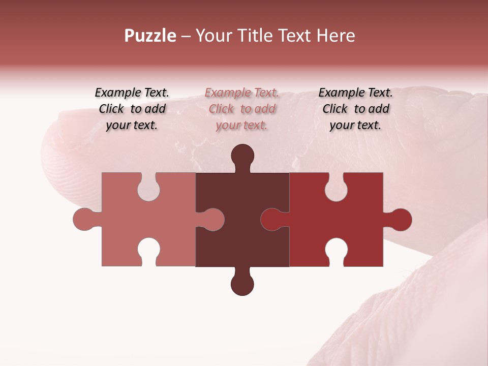 Closeup Of Eczema On Male Finger With Skin Peeling PowerPoint Template