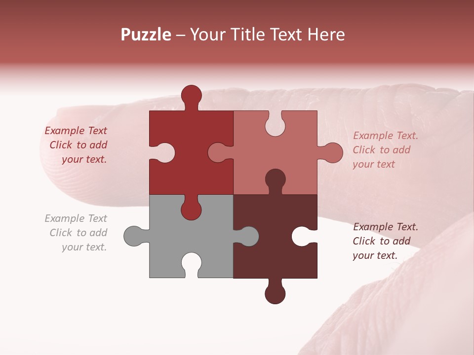 Closeup Of Eczema On Male Finger With Skin Peeling PowerPoint Template