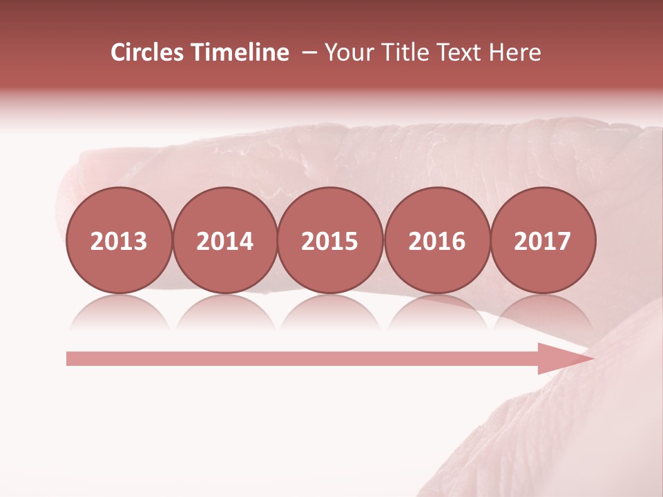 Closeup Of Eczema On Male Finger With Skin Peeling PowerPoint Template